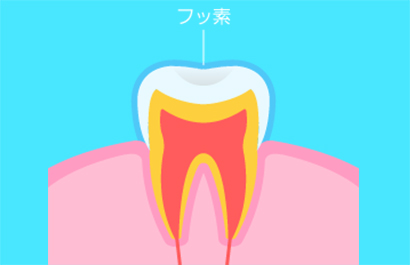 中村日赤駅・土屋歯科クリニック・フッ素塗布